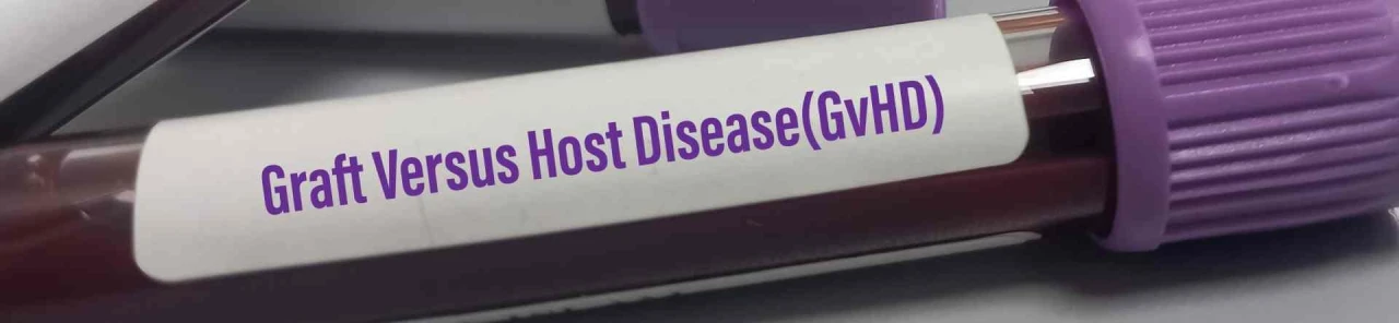 Graft Versus Host Hastalığı: Kök Hücre Nakli Sonrası Gelişen Ciddi Komplikasyonların Belirtileri ve Tedavisi
