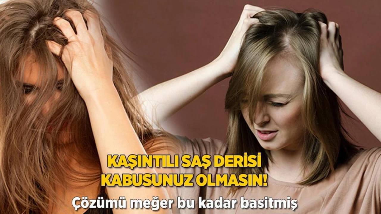 Saç Derisi Kaşıntısına Son Veren Tek Çözüm! Bu Hamleyle Rahatlayın!
