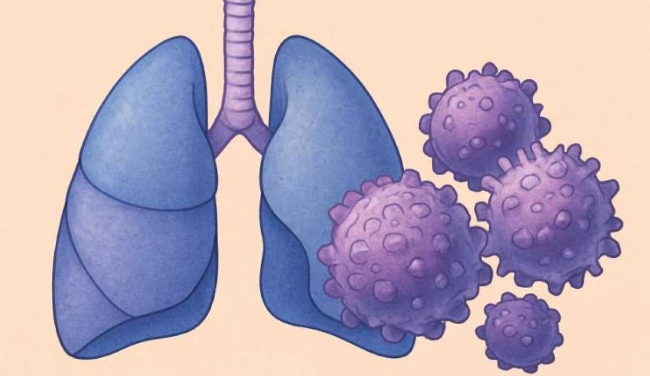Tarlatamab (Imdelltra) Nedir? FDA Onayı, Türkiye Ruhsatı ve Geri Ödeme Durumu