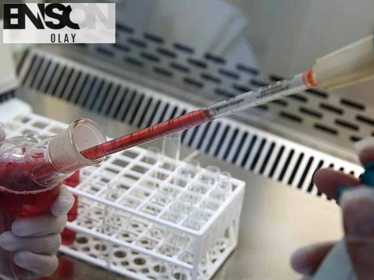 B Kan Grubuna Sahiplerin Organları Daha Dayanıklı: Yaşlanma Sürecine Karşı Üstün Savunma Mekanizması