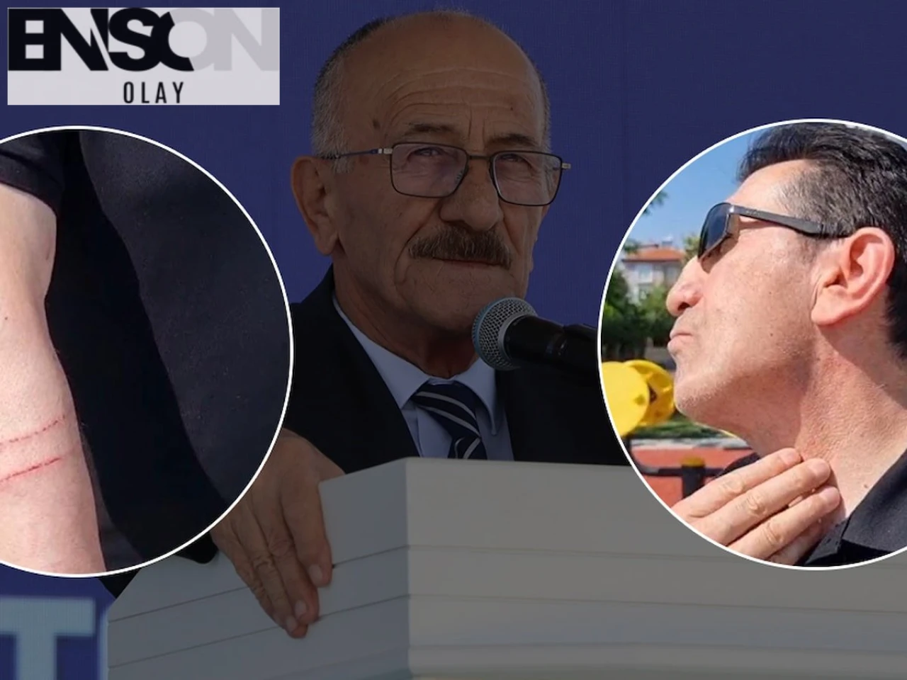 Beyşehir Belediye Başkanı Tarafından Darp Edilen Vatandaş Adil Bayındır Hakkında Şikayetçi Oldu