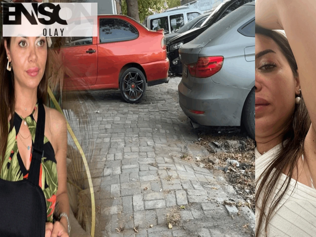 Oto Tamirhanesinin Önünde Yaşanan Kaza Sonrası Kadının Koluna 20 Dikiş Atıldı