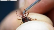 Sivas'ta KKKA hastalığı şüphesiyle tedavi gören kişi öldü