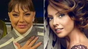 Ebru Gündeş'in estetik operasyon sonrası şaşırtıcı değişimi görenleri hayran bıraktı!
