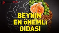 Alzheimer Hastalığına İyi Gelen Yiyecekler: Beyni Canlandıran Besinler Hangileri?