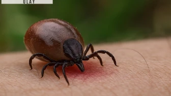 Kene ısırığıyla gelen gizli tehlike! Acil uyarı yapıldı