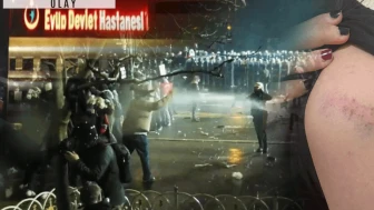 Devlet hastanesinden kırık burna 'sağlam' raporu!