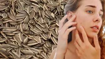 Tuzsuz Çekirdek Tüketmek Sivilce Oluşumuna Neden Olabilir mi? Çekirdek ve Sivilce İlişkisi Araştırıldı!