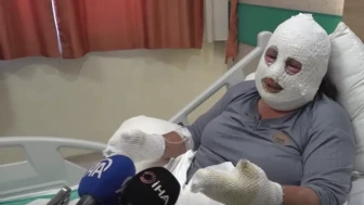 Ardahan'da evladını alevlerin arasından kurtaran annenin tedavisi Erzurum'da sürüyor