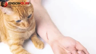 Kedi , köpek ısırıkları ve çiziklerinde dikkat edilmesi gerekenler neler?