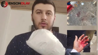 Antalya'da korkunç olay: Sipariş teslimatı için giden kişi döner bıçağıyla saldırıya uğradı