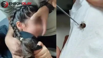 Eskişehir'de 5 yaşındaki çocuğun kulağından canlı kene çıkarıldı