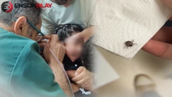 Bir aydır süren kulak ağrısının altından çıkan gerçek şoke etti! Kulağından canlı kene çıkarıldı