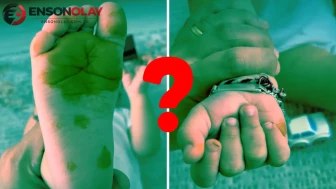 Çocuğunun el ve ayaklarını görünce korktu: Yediği şeyden olduğu ortaya çıktı