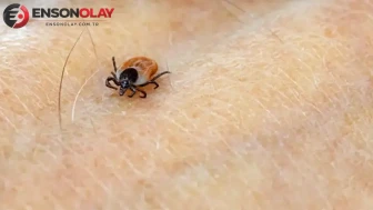 Çin'de kenelerden bulaşan yeni ALTNV Virüsü nedir ? Ne tehditler oluşturuyor ?