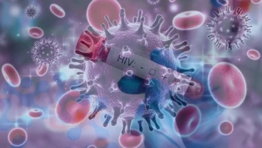 HIV'i hücrelerden çıkarmak için yeni yöntem geliştirdi