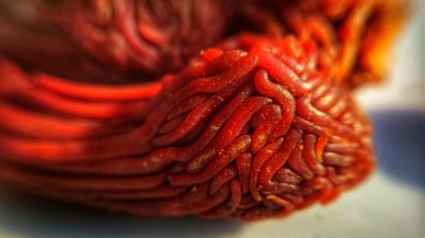 Sindirim Sistemini Hızlandıran Doğal Ağrı Kesici: Baharatlar