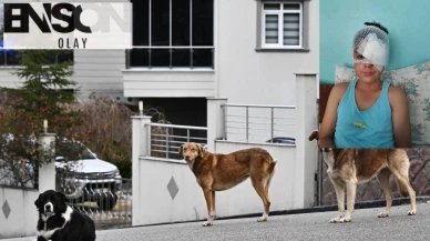 Şanlıurfa'da dehşet: Köpekten kaçarken araba çarptı
