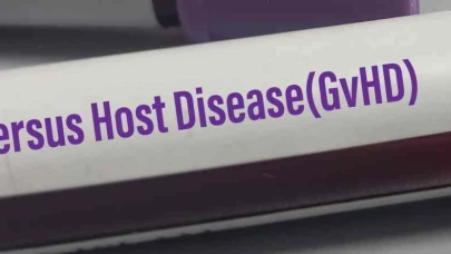 Graft Versus Host Hastalığı​ Nedir? Graft Versus Host Hastalığı​ Belirtileri Ve Tedavisi