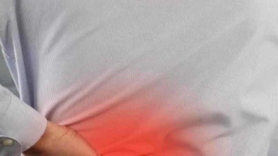 Kas Yanması Hakkında Bilmeniz Gerekenler ve Sebepleri Nelerdir?