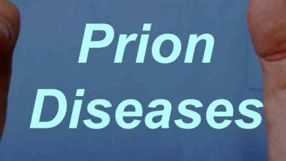 Prion Nedir? Prion Hastalığı Belirtileri ve Tedavisi