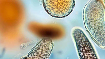Toksik Epidermal Nekroliz (TEN) Nedir? Toksik Epidermal Nekroliz Belirtileri