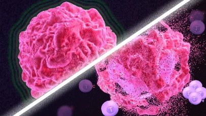 Kanser Ölümleri Gelecek 25 Yılda Üç Katına Çıkabilir