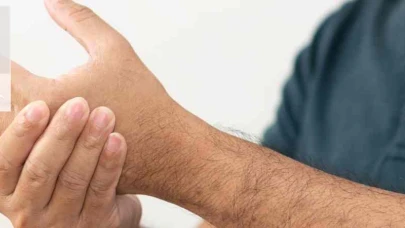 Miller Fisher Sendromu, nadir görülen bir nörolojik hastalıktır. Bu sendrom, genellikle üst solunum yolu enfeksiyonunu takiben gelişen ve vücudun bağışıklık sisteminin kendi sinir hücrelerine saldırması sonucu ortaya çıkar. Miller Fisher Sendromu belirtileri arasında çift görme, yüz felci, dengesizlik, kas zayıflığı ve reflekslerde azalma bulunur. Tedavisi genellikle belirtilere yönelik olup, hastalığın seyri genellikle iyileşme eğilimindedir.
