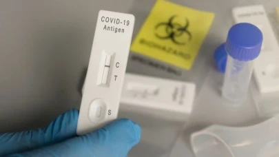 Covid-19 test kitleri ile başarı yakalamıştı... Türkiye'nin dev tıbbi malzeme firması mali darboğazda!