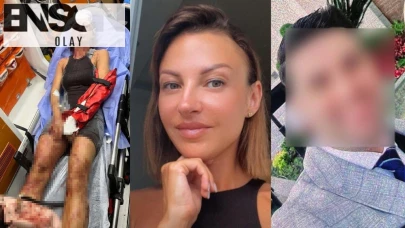 Sopayla saldırdı, kafasına zımba atıldı! Antalya'da eş dehşeti