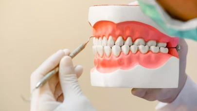 Diş eti iltihabında acıyı hafifletmenin doğal yolu keşfedildi! Hemşire arıyor!