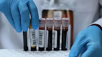 Kan Grubu Olanlar Daha Mı Sağlıklı? Kanser ve Erken Ölüm Riski Kan Grubuyla Bağlantılı mı?