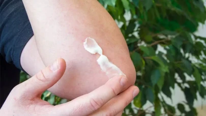 Antibiyotikli Pomad Thiocilline: Kullanımı, Yan Etkileri ve Fiyatı Hakkında Detaylı Bilgiler!