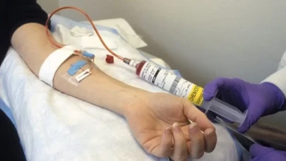 Kemoterapi Nedir? Kanser Tedavisinde Kullanımı ve Yan Etkileri