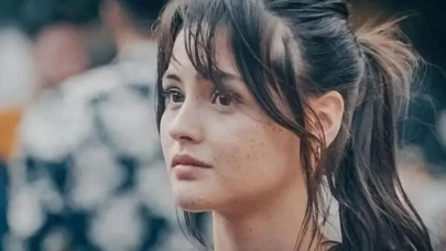 Derya Pınar Ak'ın Çillerleri Doğal Güzelliğinden mi Kaynaklanıyor Yoksa Makyajın Eseri mi?