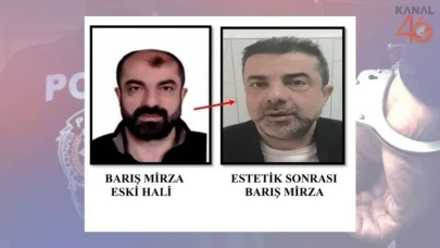 Kimdir Barış Mirza? Firarının ardındaki 16 yıllık estetik ameliyat sırrı!