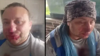 Onur Akay'ın Sağlık Durumu İyileşme Sürecinde: Neden Entübe Edildi?