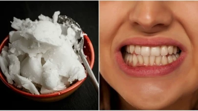 Hindistan Cevizi Yağı Diş Sağlığına İyi Geliyor: İşte Uygulama Yöntemleri