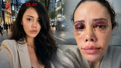 Survivor eski yarışmacısı Didem Ceran, yüz nakli operasyonu geçirdiği için CİMER'e açıklama yaptı