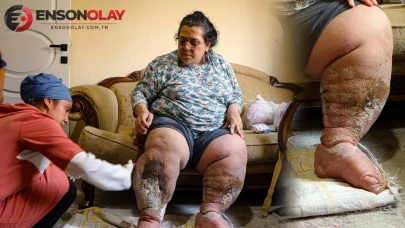 Hastalık nedeniyle tedavisi yarıda kalan genç anne, hayallerini ertelemek zorunda kaldı!