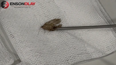 Kulağından 'kelebek' çıktı: Hareketliydi, doğaya bıraktık