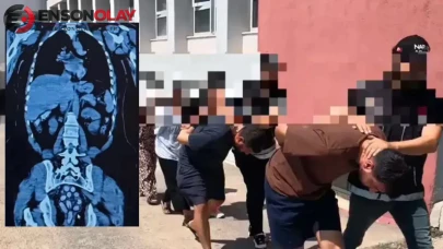 Adana otogarında yakalandılar, gerçek hastanede ortaya çıktı : Midelerinden 1,5 kilo uyuşturucu çıktı