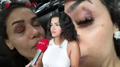 Bahçeşehir'de uzaklaştırma kararına rağmen darbedilen kadın : Ölmeden önce sesimi duyun