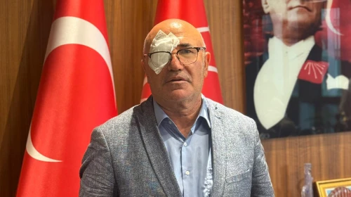 Mahmut Tanal'ın Gözüne Ne Oldu? Mahmut Tanal'ın Gözü Neden Kapalı?