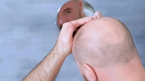 20 günde sonuç veren tedavi klinik denemelere başlıyor