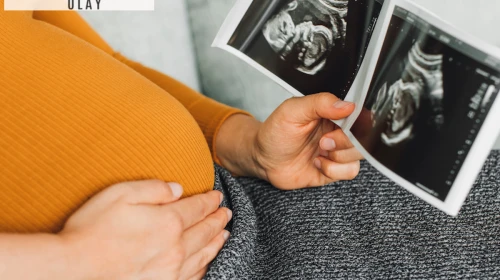 Tüp bebek tedavisini bu ayda yapanlar hemen gebe kalıyor