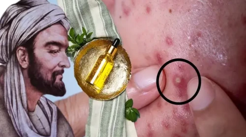 İbn-i Sina'nın sivilce reçetesi! Kremleri gölgede bırakan yağ