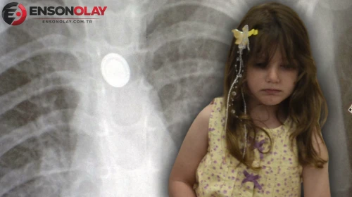 Üç yaşındaki küçük kızın yuttuğu saat pili hastanede çıkarıldı: Doktorlardan ailelere uyarı