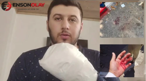 Antalya'da korkunç olay: Sipariş teslimatı için giden kişi döner bıçağıyla saldırıya uğradı