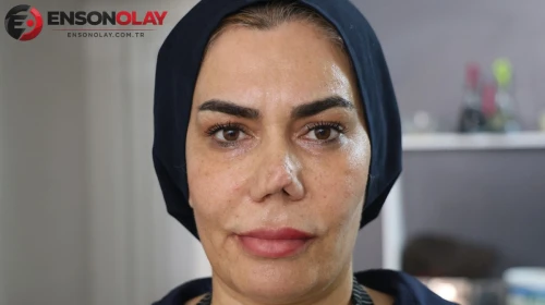 Her ameliyat öncesi tam altın verdi, son halini görünce aynalara küstü